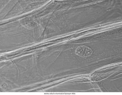 Mikroskop Delta Optical Genetic Pro Bino Delta-Optical-Genetic-Pro-Bino-11.jpg