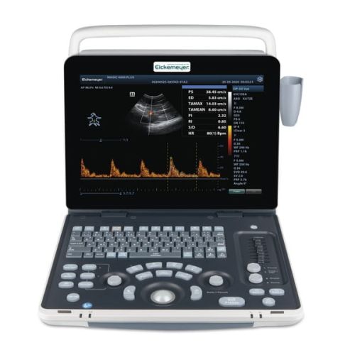 Mobilný ultrazvukový skener Magic 6000 PLUS Mobilne USG weterynaryjne Magic 6000 PLUS – zaawansowane urządzenie diagnostyczne dla małych zwierząt i koni