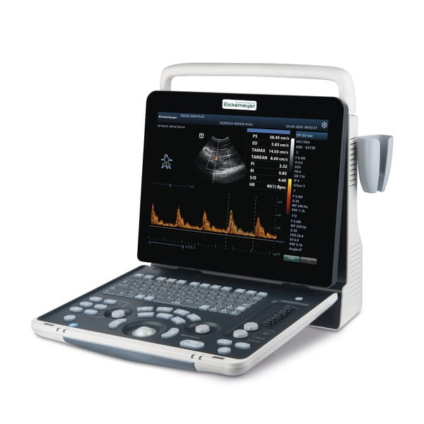 Mobilne USG weterynaryjne Magic 6000 PLUS – zaawansowane urządzenie diagnostyczne dla małych zwierząt i koni