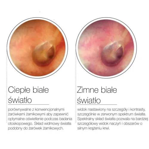 Otoskop Auris CCT LED Luxamed Otoskop otoskop-luxascope-auris-cct-led-dwie-barwy-swiatla (4).webp
