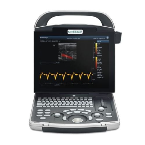 Mobilný ultrazvukový skener Magic 3000 PLUS + sonda Kolorowy ekran LCD urządzenia USG Magic 3000 PLUS – doskonała jakość obrazu i zaawansowane funkcje obrazowania