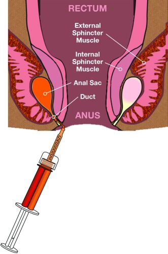 Súprava na odstránenie perianálnej žľazy J1490-2.jpg