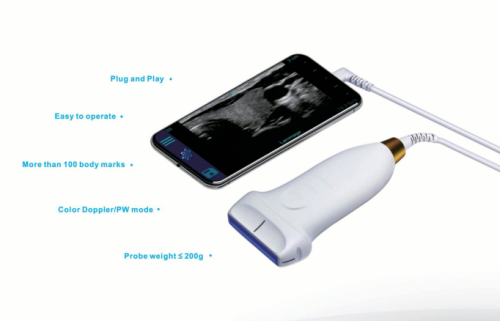 Ultrazvukový skener UMAGIC S Landwind Bezprzewodowy ultrasonograf UMAGIC S Landwind do diagnostyki medycznej i weterynaryjnej na smartfonie i tablecie