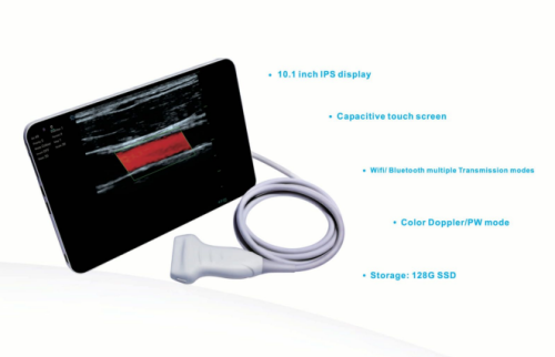 Ultrazvukový skener UMAGIC S Landwind Bezprzewodowy ultrasonograf UMAGIC S Landwind do diagnostyki medycznej i weterynaryjnej na smartfonie i tablecie